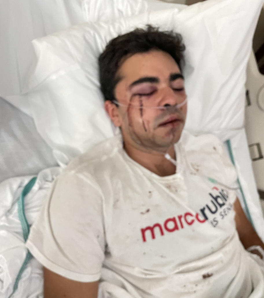 GOP Canvasser In Hialeah Stabbed, Beaten By Four Who Said 'Republicans Don't Belong Here'